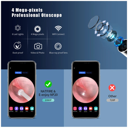 Wireless Smart Visual Ear Cleaner Otoscope NP20 Ear Wax Removal Tool with Camera Ear Endoscope 1080P Kit for iPhone iPad Android