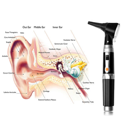 Kit de diagnóstico de Otoscopio profesional, endoscopio médico para el cuidado de los oídos, otoscopio LED portátil, limpiador de oídos con 8 puntas