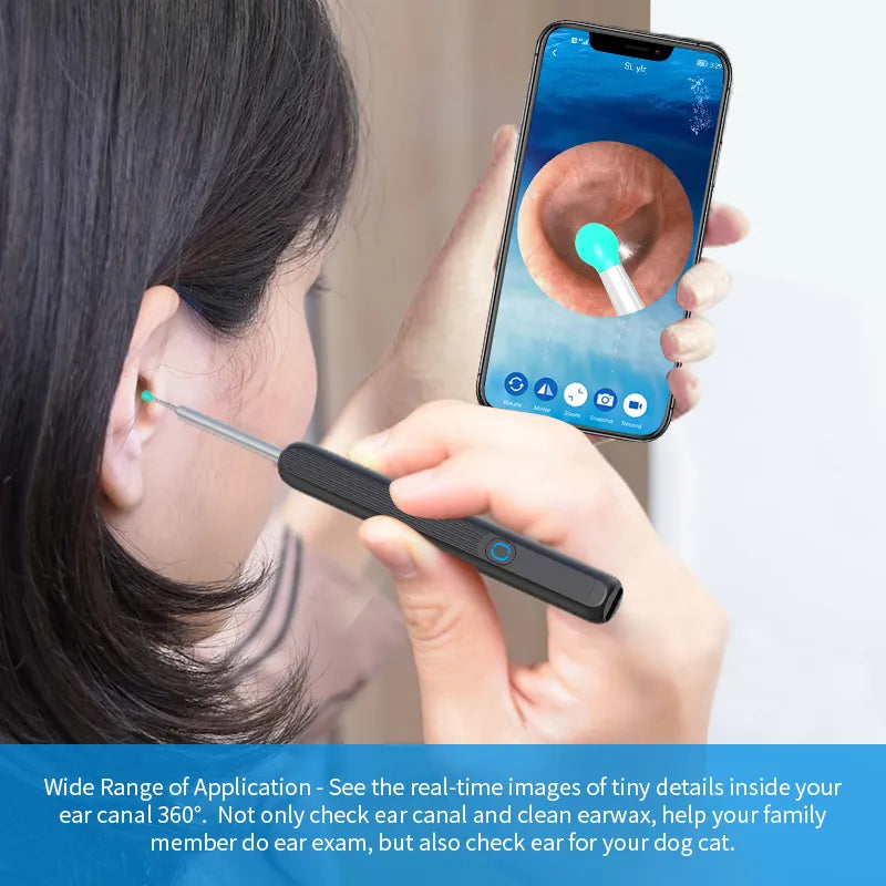 Limpiador de oídos NE3, herramienta de eliminación de cera de los oídos de alta precisión con cámara, luz LED, otoscopio inalámbrico, Kit de limpieza de oídos inteligente, el mejor regalo